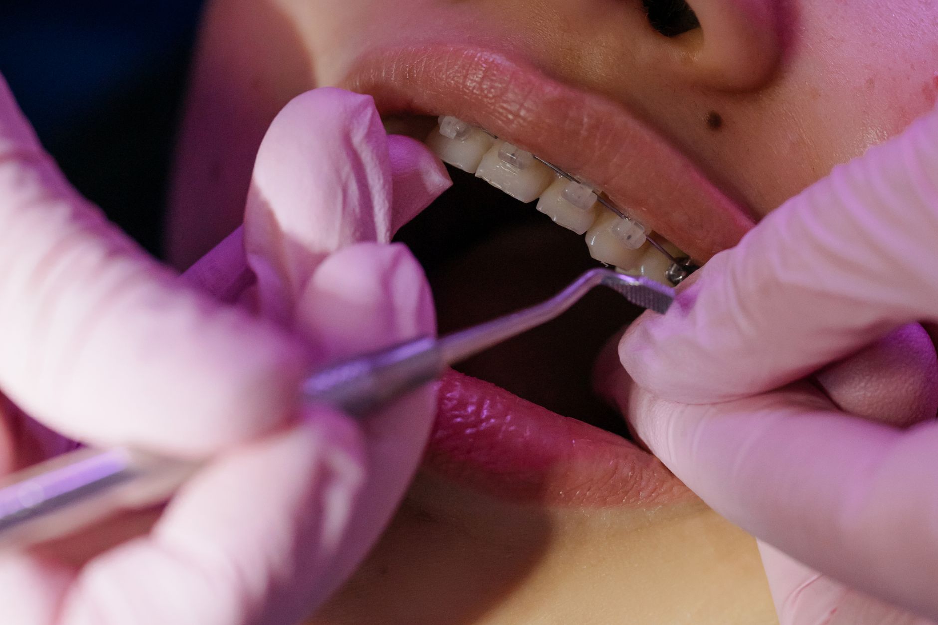 Dental professional adjusting a patient's orthodontic braces